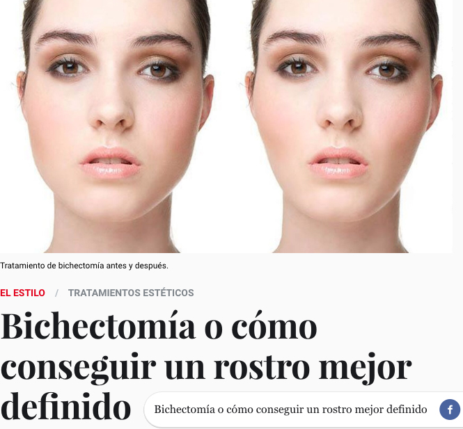 Bichectomía o cómo conseguir un rostro mejor definido