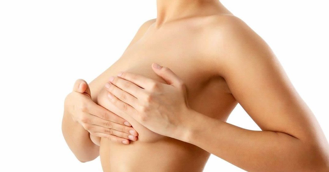 ¿Qué debes saber antes de una mastectomía?