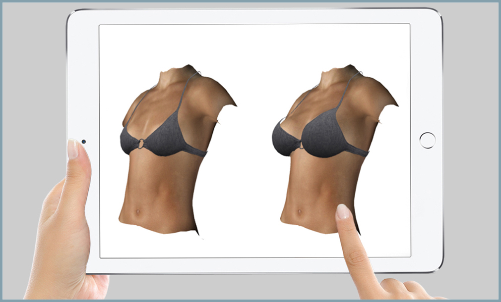 Simulador 3D Cirugía Estética Visualiza el 3D